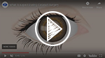 Cataract Surgery Video